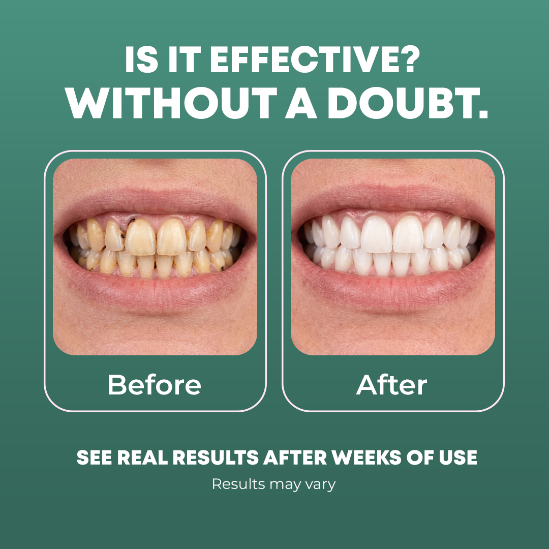 Ultimate Daily Oral Care Routine