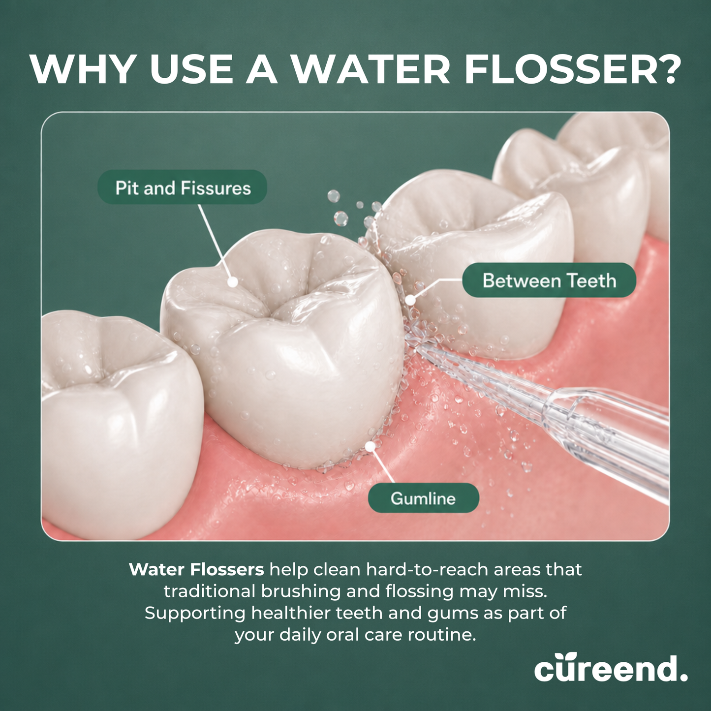 Deep Clean Water Flosser