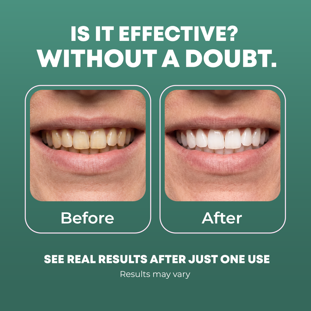 Coconut Oil Pulling