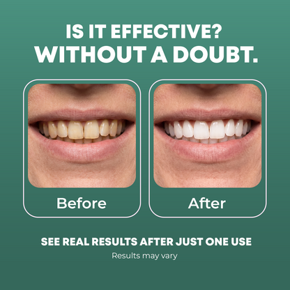 Coconut Oil Pulling