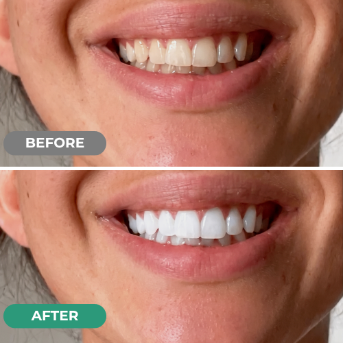 Ultimate Daily Oral Care Routine