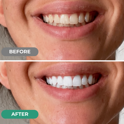 Ultimate Daily Oral Care Routine