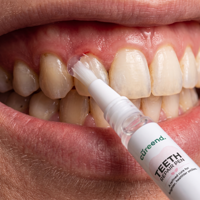Bleeding Gums